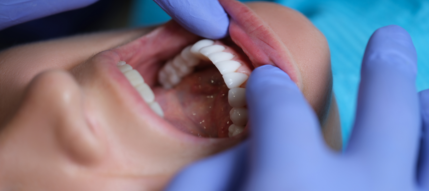 Máster en Cirugía Oral, Implantología y Periodoncia