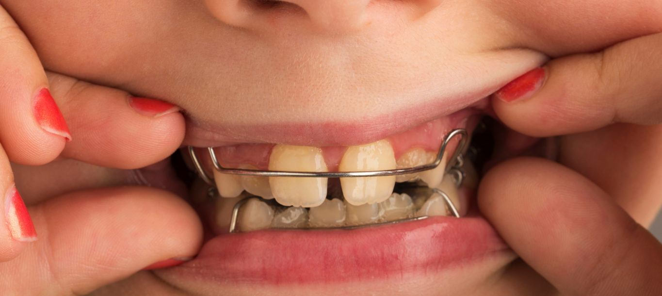 Máster Universitario en Ortodoncia y Ortopedia Dentofacial